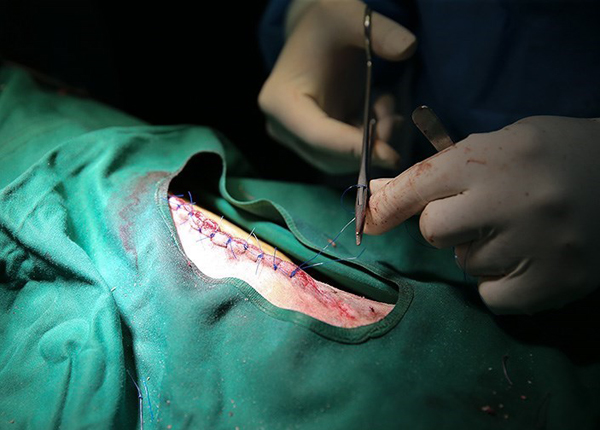  عمل جراحی پلنگ زخمی خرم‌آباد+تصاویر 