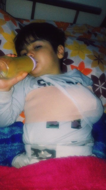 شکستن استخوان ترقوه‌ پسر 3 ساله در مهدکودک