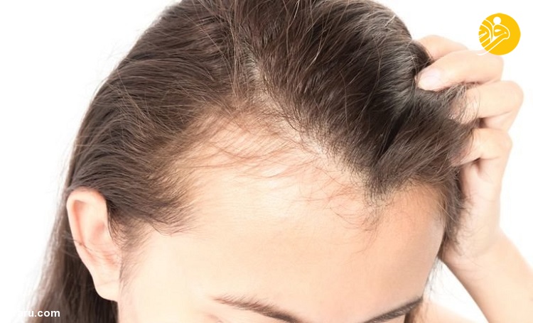 دلایل رایج ریزش مو در تابستان و پاییز چیست؟
