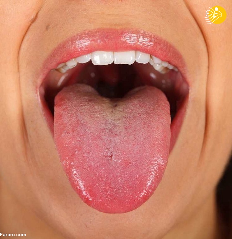 میکروبیوم دهان چیست؟
