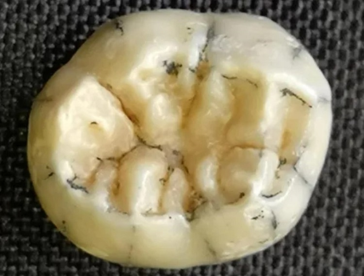 (تصاویر) معمای دندان تازه کشف شده یک دختر بچه ۱۶۰ هزار ساله!
